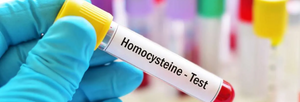 Homocysteine: A Crucial Part of the Body's Methylation Process